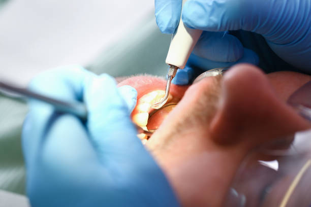 Best Emergency Dental Care for Broken or Chipped Teeth in Frankl, IN